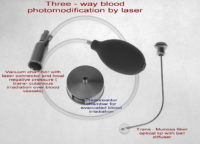 Рекс - Лазерный терапевтический комплекс